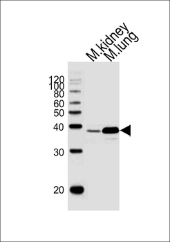 Mouse Hoxa1 Antibody (Center)