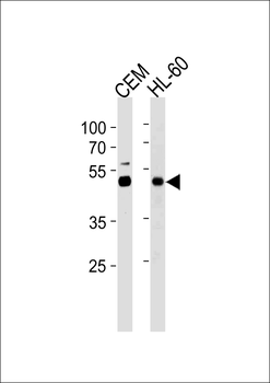 BLMH Antibody (Center)
