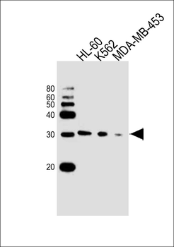 SSPN Antibody (N-term)