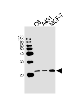 NRAS Antibody (N-term)