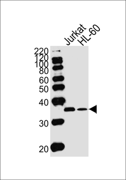 TYSY Antibody (C-term)
