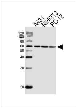 HSPD1 Antibody (Center)