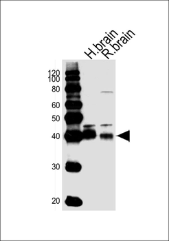 ALDOC Antibody (C-term)