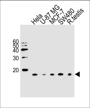 UBE2D2 Antibody (N-term)