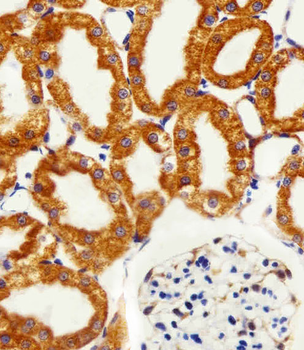 NDUFC2 Antibody (N-term)