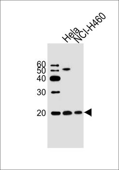 NME1 Antibody (C-term)
