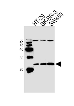 HAND1 Antibody (Center)