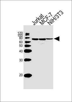 RPS6KB2 Antibody
