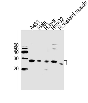 MMAB Antibody (Center)