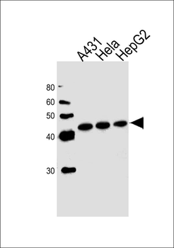 CSNK2A1 Antibody (Center)
