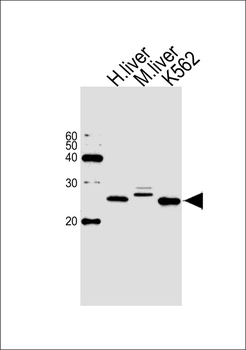 BLVRB Antibody (C-term)