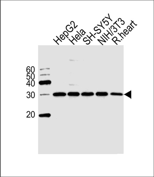 VAPB Antibody (Center)