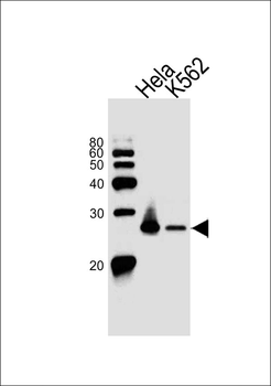 MAD2L2 Antibody (C-term)