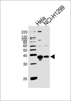RPL6 Antibody (N-term)