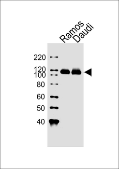 PTK2B Antibody (C-term)