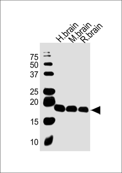 VILIP1 Antibody (C-term)