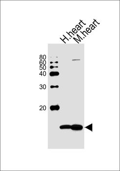 NDUFV3 Antibody (C-term)