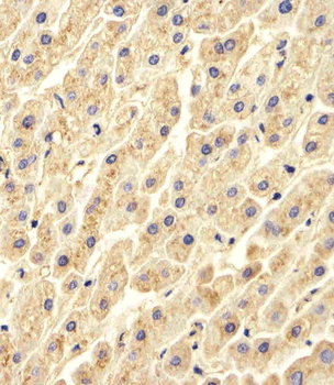 CTSD Antibody