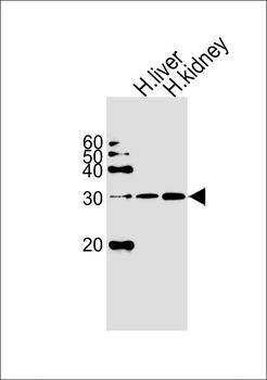 ECHDC3 Antibody (N-term)