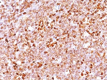 Anti-CD79a Antibody