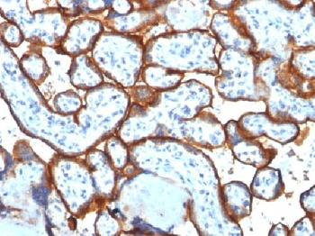 Anti-CD71 / Transferrin Receptor (TFRC) (Extracellular Domain) Antibody