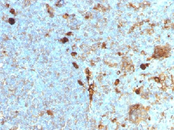 Anti-Alpha-1-Antitrypsin (SERPINA1) Antibody