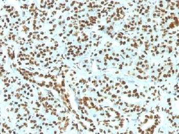 Anti-Histone H1 (Nuclear Marker) Antibody