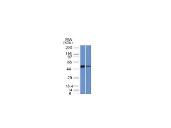 Anti-ALDH1A1 (Aldehyde Dehydrogenase 1A1) Antibody