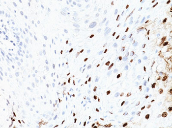 HPV-16 (Human Papilloma Virus 16) Antibody - With BSA and Azide