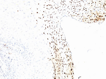 HPV-16 (Human Papilloma Virus 16) Antibody - With BSA and Azide