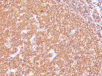 CD20 / MS4A1 (B-Cell Marker) Antibody - With BSA and Azide