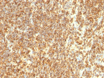 CD20 / MS4A1 (B-Cell Marker) Antibody - Culture Supernatant