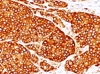 Tyrosinase (Melanoma Marker) Antibody - With BSA and Azide