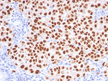SOX10 (Melanoma Marker) Antibody - With BSA and Azide
