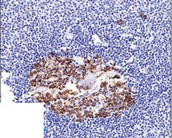 CDw75 (B-Cell Marker) Antibody - With BSA and Azide