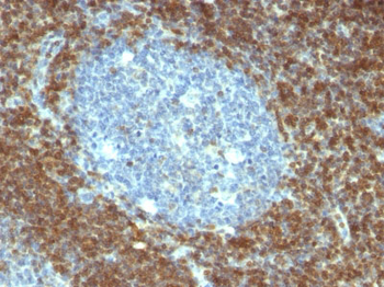 Bcl-2 (Apoptosis & Follicular Lymphoma Marker) Antibody - With BSA and Azide