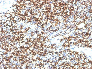 PAX7 (Rhabdomyosarcoma Marker) Antibody - With BSA and Azide
