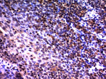 Nuclear Mitotic Apparatus Protein (NuMA) Antibody - With BSA and Azide