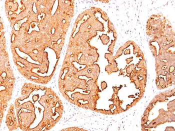 MUC1 / EMA / CD227 (Epithelial Marker) Antibody - With BSA and Azide