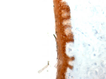 Cytokeratin 10 (KRT10) (Suprabasal Epithelial Marker) Antibody - With BSA and Azide