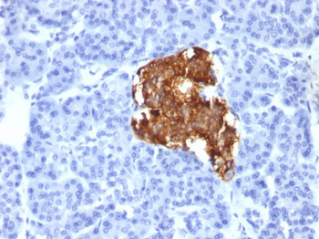 Insulin / IRDN (beta-Cell & Insulinoma Marker) Antibody - With BSA and Azide