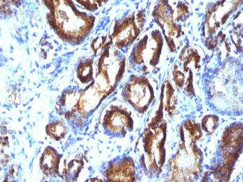 Prostate Specific Antigen (PSA) Antibody - With BSA and Azide