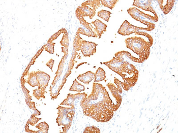 Prostate Specific Antigen (PSA) Antibody - With BSA and Azide