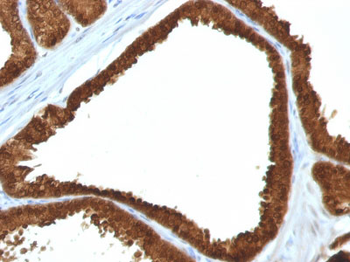 IDH1 (Isocitrate Dehydrogenase) Antibody - With BSA and Azide
