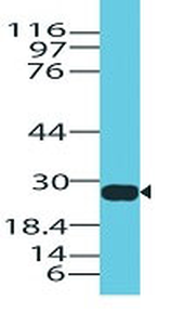 Granzyme B (NK/T-Cell Lymphoma Marker) Antibody - With BSA and Azide