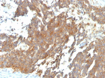 GnRH-Receptor / LH-RH Receptor Antibody - With BSA and Azide