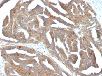 GnRH-Receptor / LH-RH Receptor Antibody - With BSA and Azide