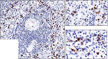 CD57 / B3GAT1 (Natural Killer Cell Marker) Antibody - With BSA and Azide