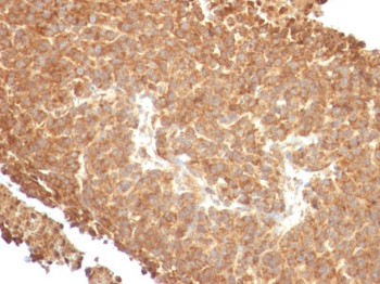 Topoisomerase (DNA) I, Mitochondrial (TOP1MT) Antibody - With BSA and Azide