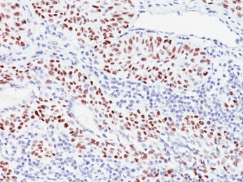 p57Kip2 (Mitotic Inhibitor/Suppressor Protein) Antibody - With BSA and Azide